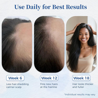 Rosemary Hair Growth Serum