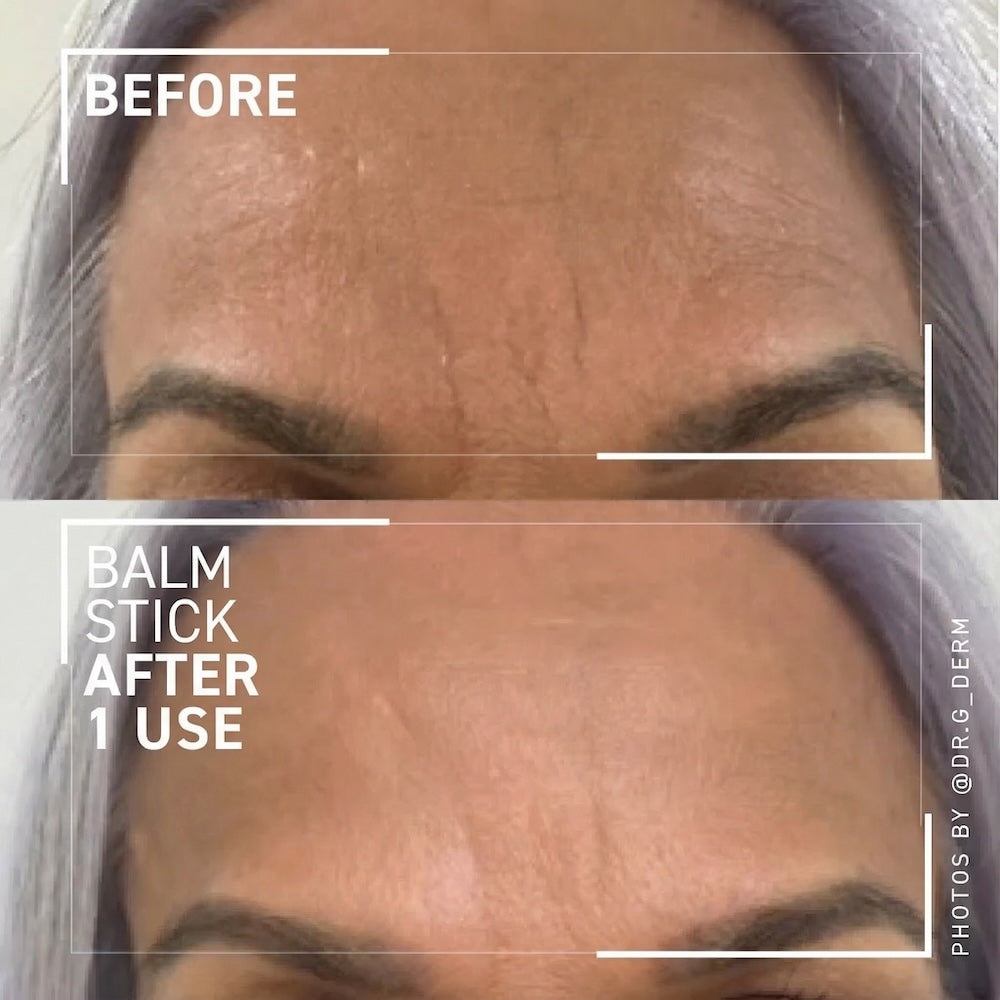 Calcium Eye & Wrinkle Balm