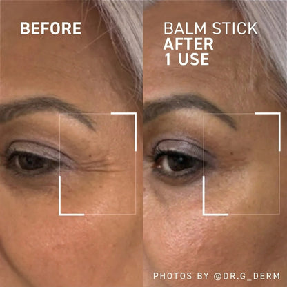 Calcium Eye & Wrinkle Balm