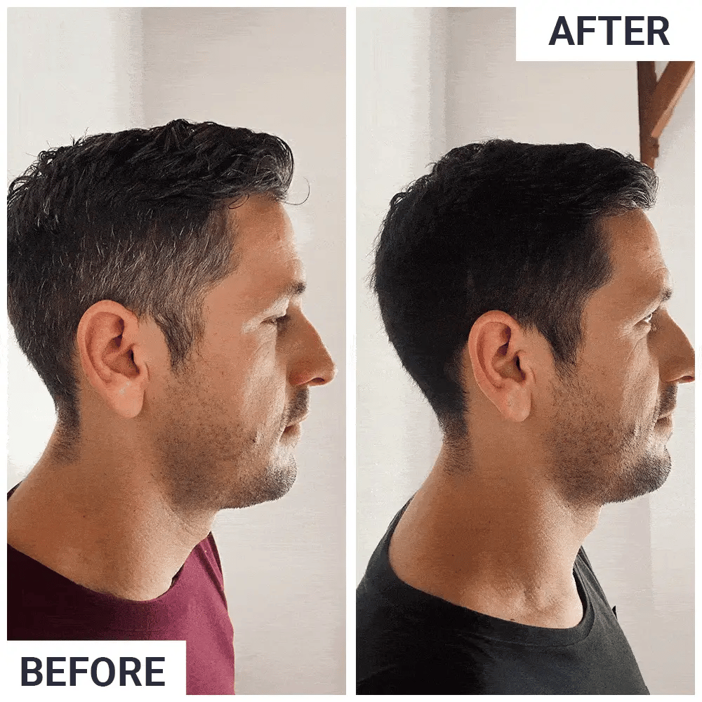 Why Grey Hair Reverse Bar works when box dyes don't